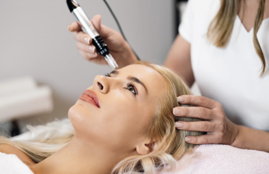 Microneedling + BioRePeel at 🤍pSb Luxe Beauty🤍 in Tottenville, NY