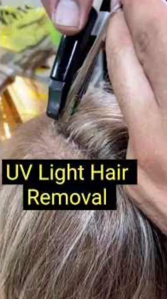 V-Light Extension Removal