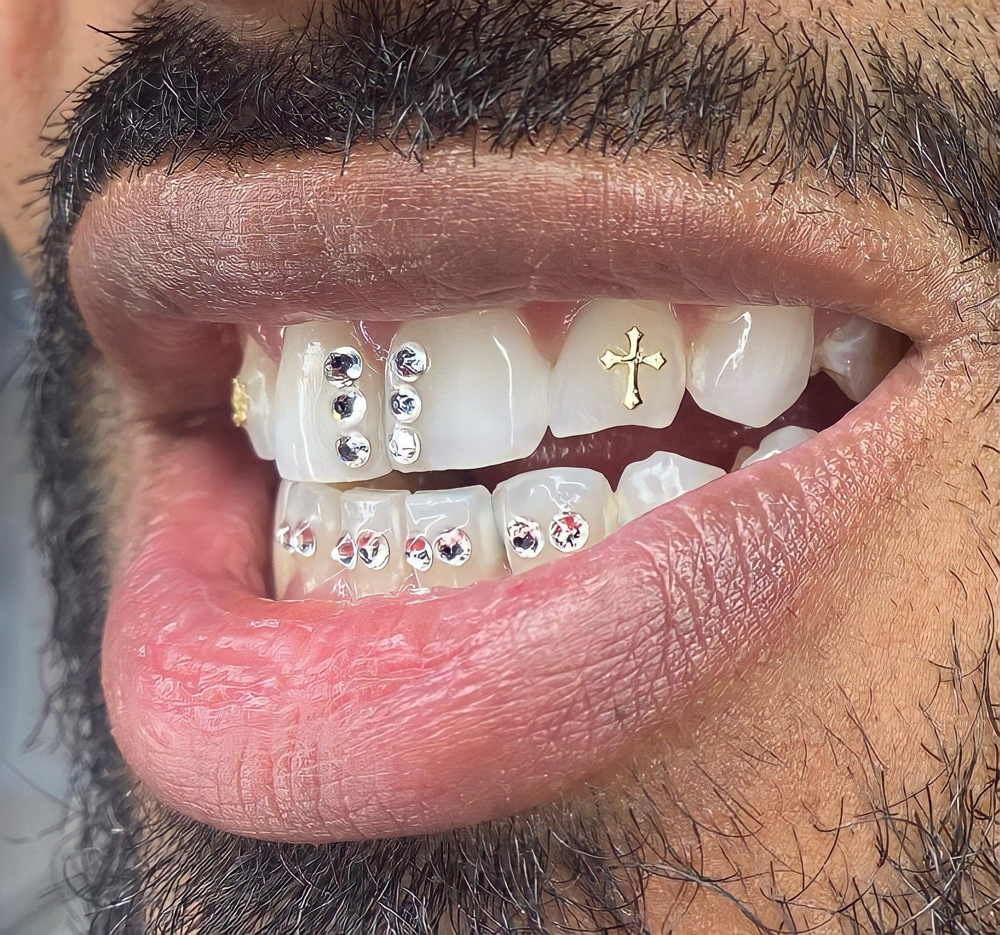 Tooth Gem Consultation at Manifest Management LLC in Spokane, WA