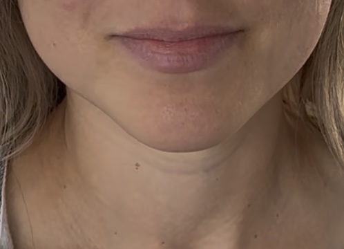 Neck Threading