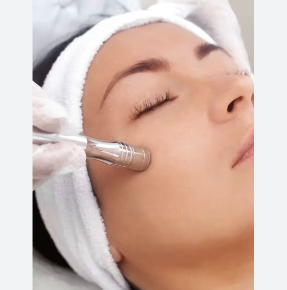 Microderm Facial