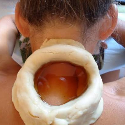 Greeva Basti (Neck Treatment) at Kerala Ayurveda Panchakarma Center LLC in brandon, FL