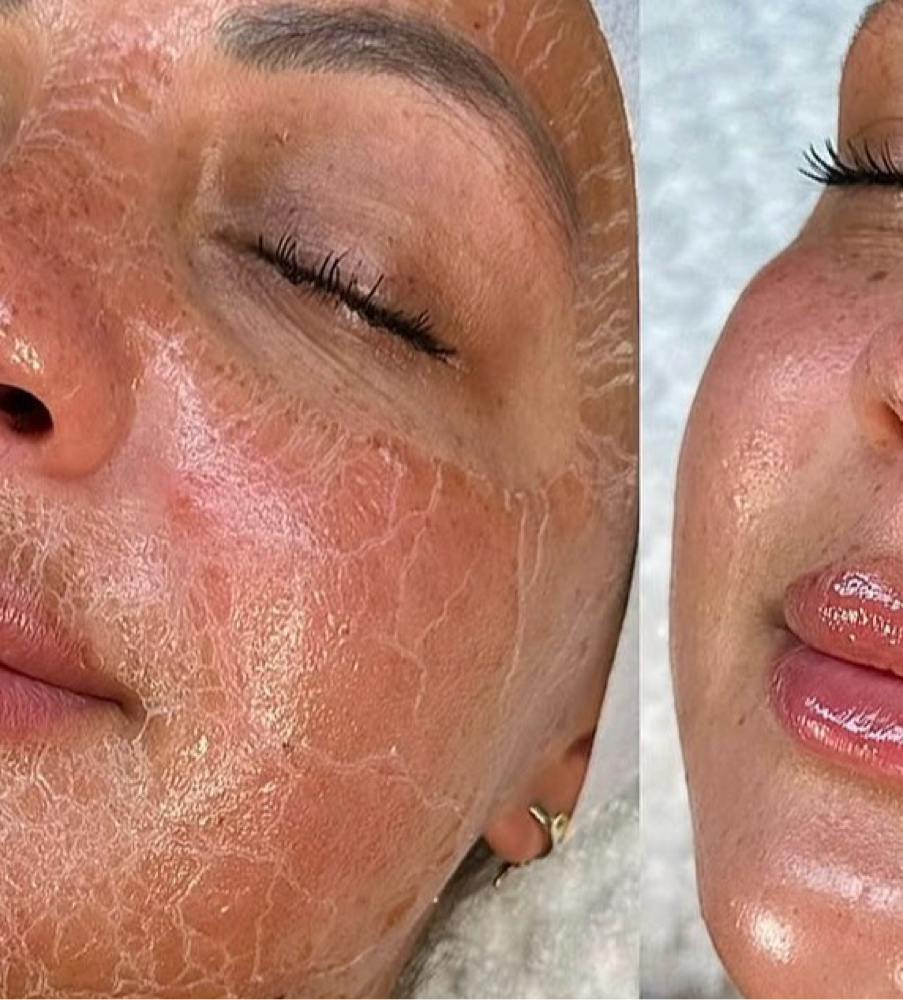 Peptide Firming Facial at Beauty By Jumilka in Perth Amboy, NJ