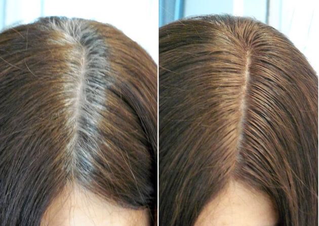 Root Touch Up