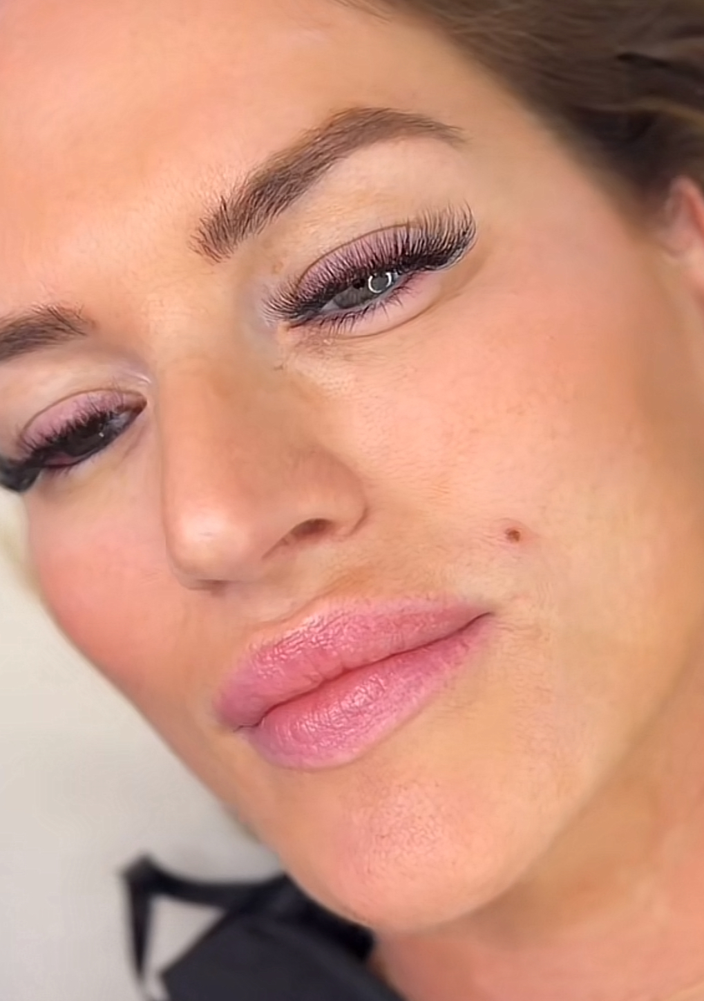 Beauty Marks