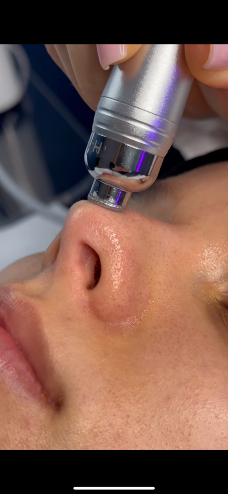 HYDRODIAMOND® ADVANCED FACIAL