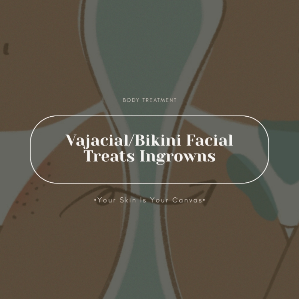 Vajacial/Bikini Facial at Face Palette Aesthetics in Franklin, WI