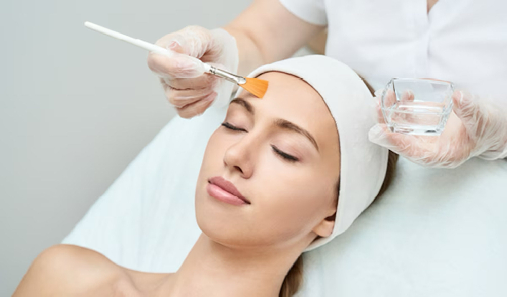 Chemical Peel Facial