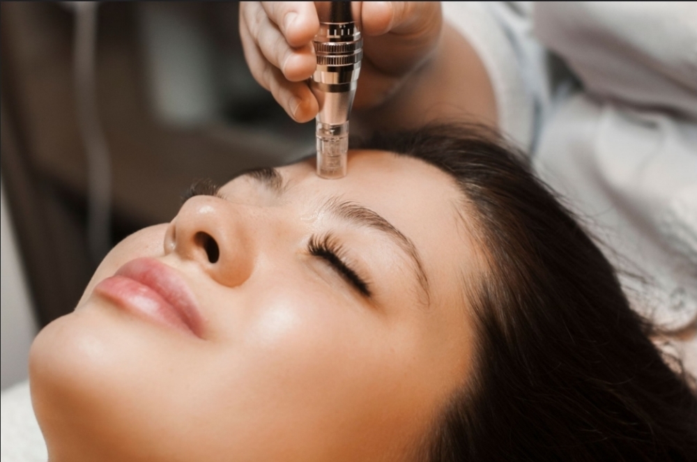 Microneedling