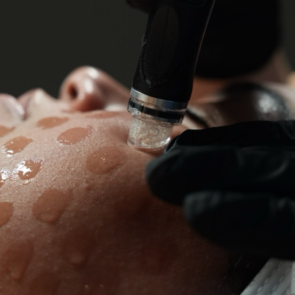 Deluxe HydraFacial™ at Skintuition Skincare Boutique in Pewee Valley, KY