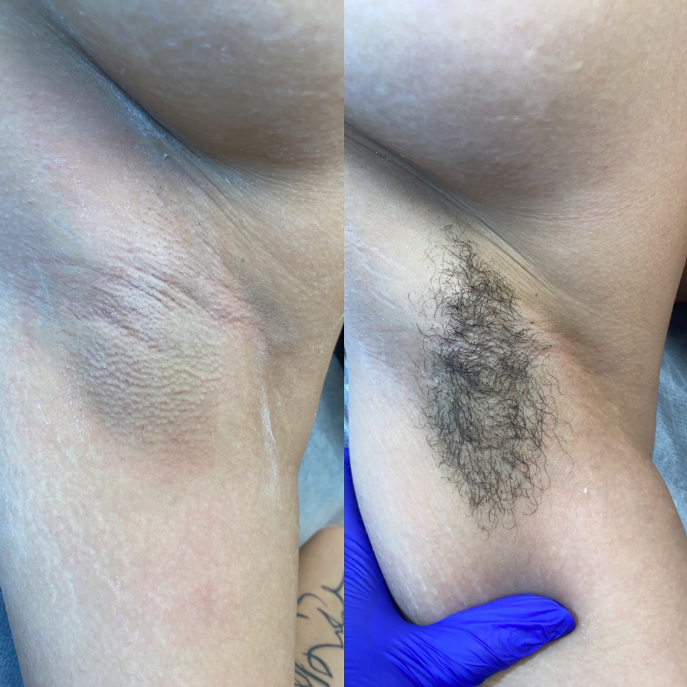 Underarm Wax