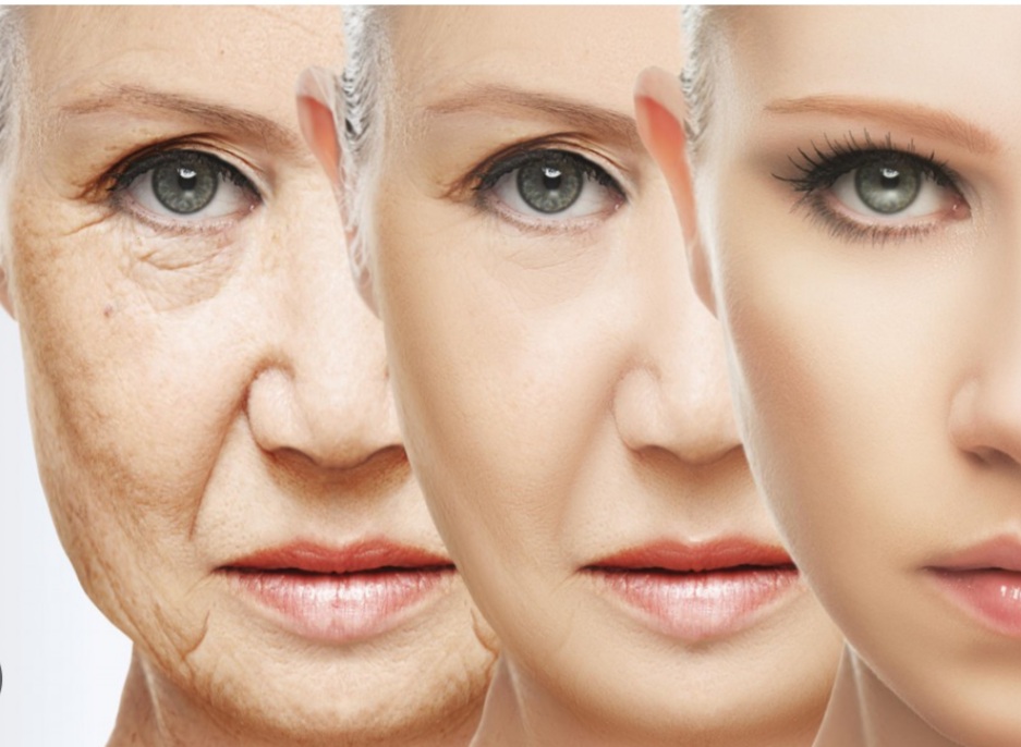 Anti-Aging