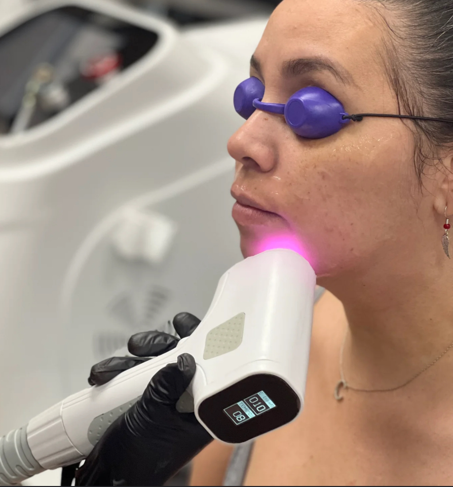 Laser Hair Removal