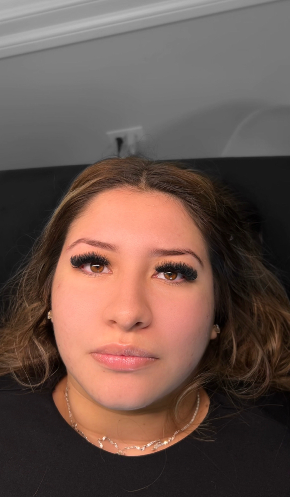 Mega Volume Fill