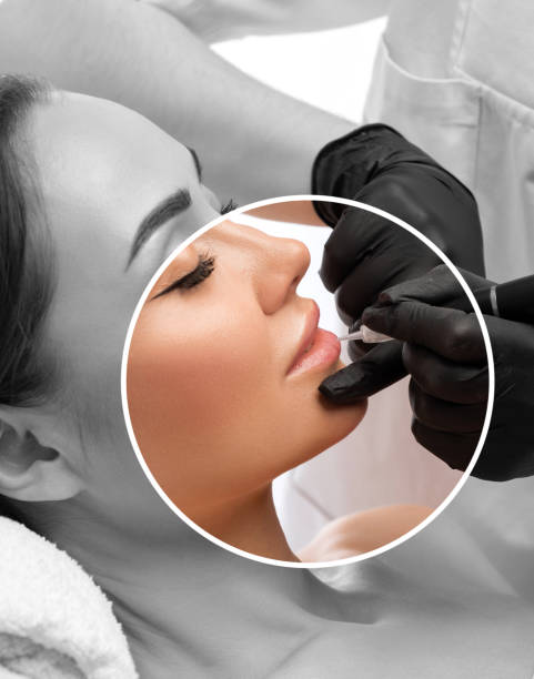 Lip Neutralization