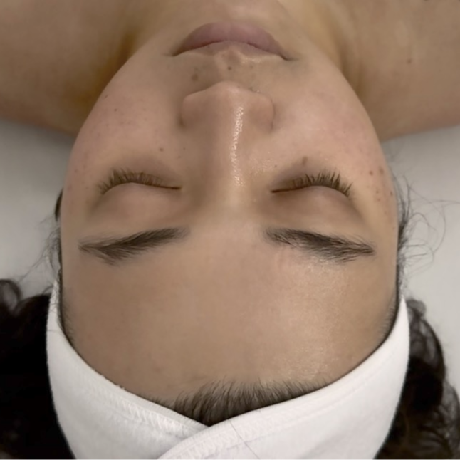 Back Facial - 60 Minutes at EstheticallyMei LLC in Lansing, MI