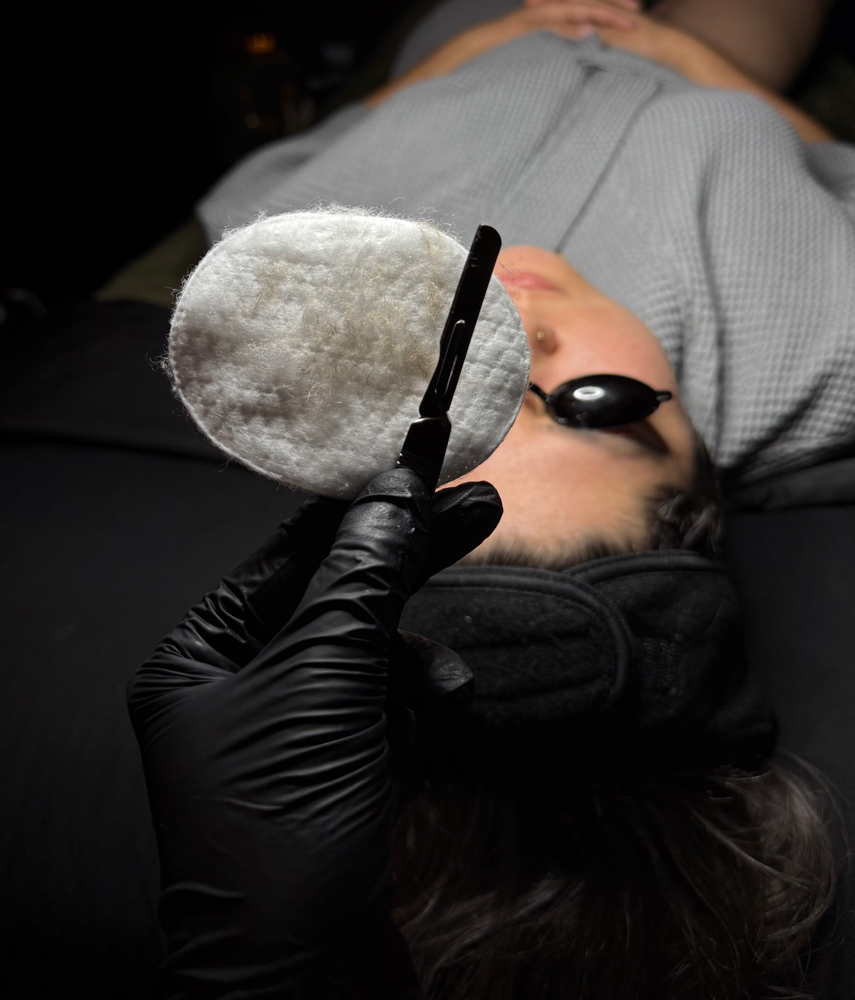 Dermaplaning (add On)