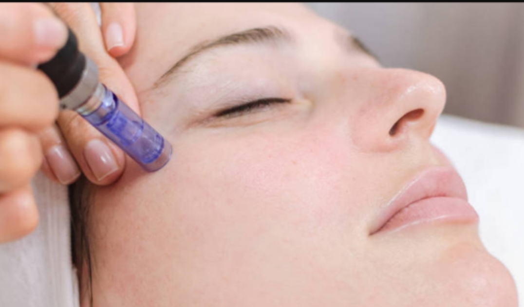 Nano Needling Therapy(non invasive)