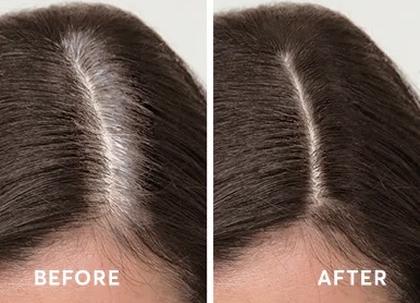 Root Retouch