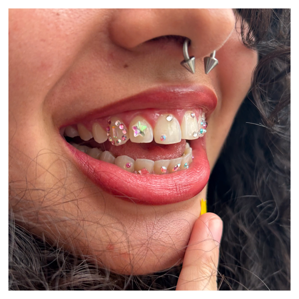 CLASSIC FREESTYLE - Whole mouth at PsychoTeeth in manhattan, NY