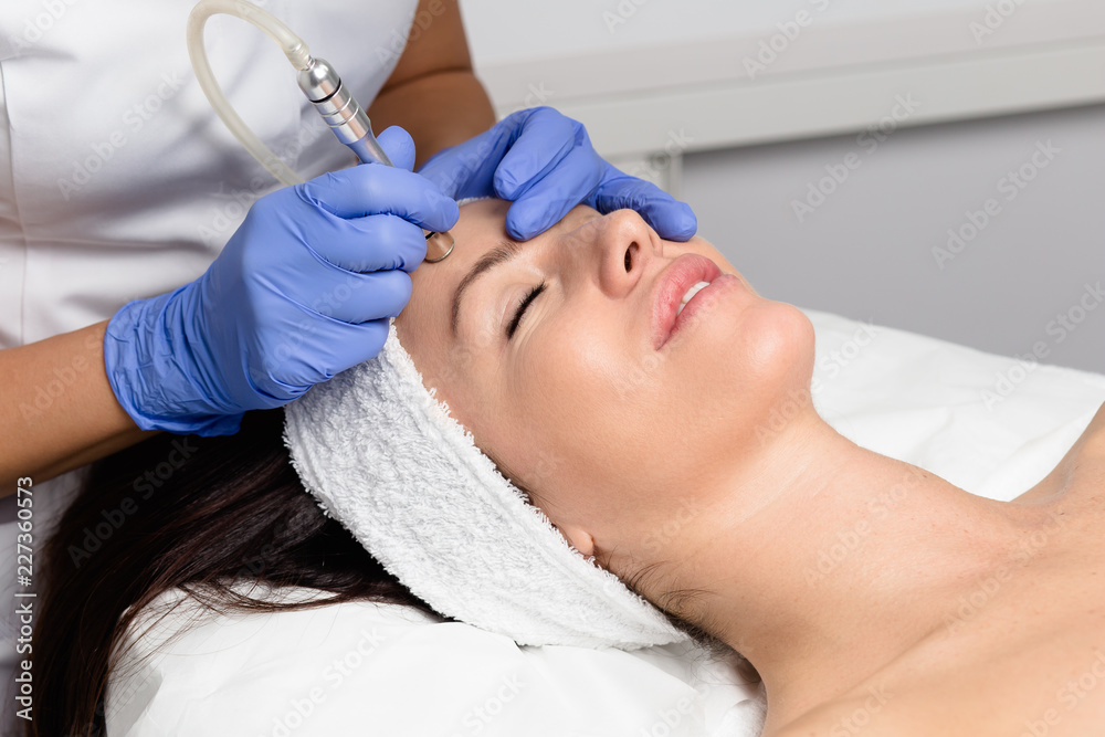 Microdermabrasion Treatment