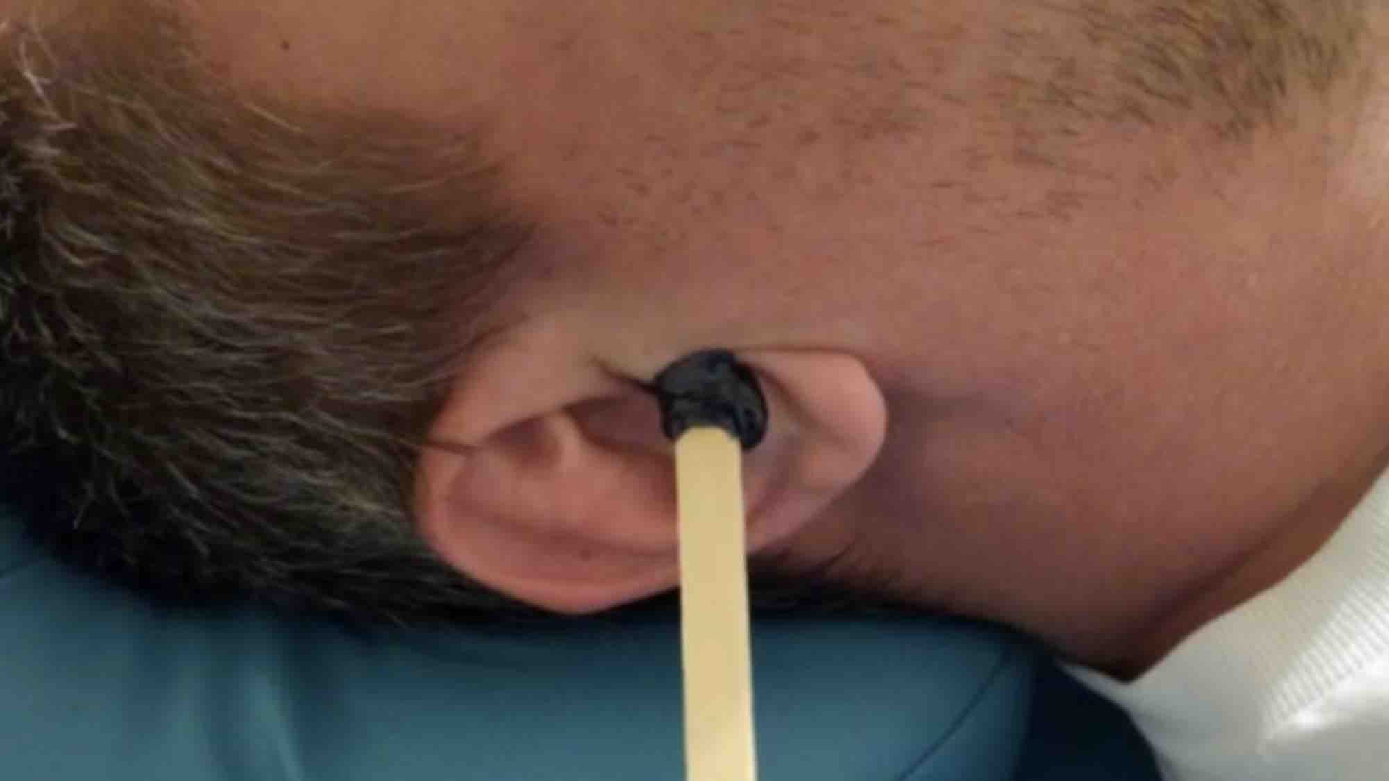 Ear Waxing