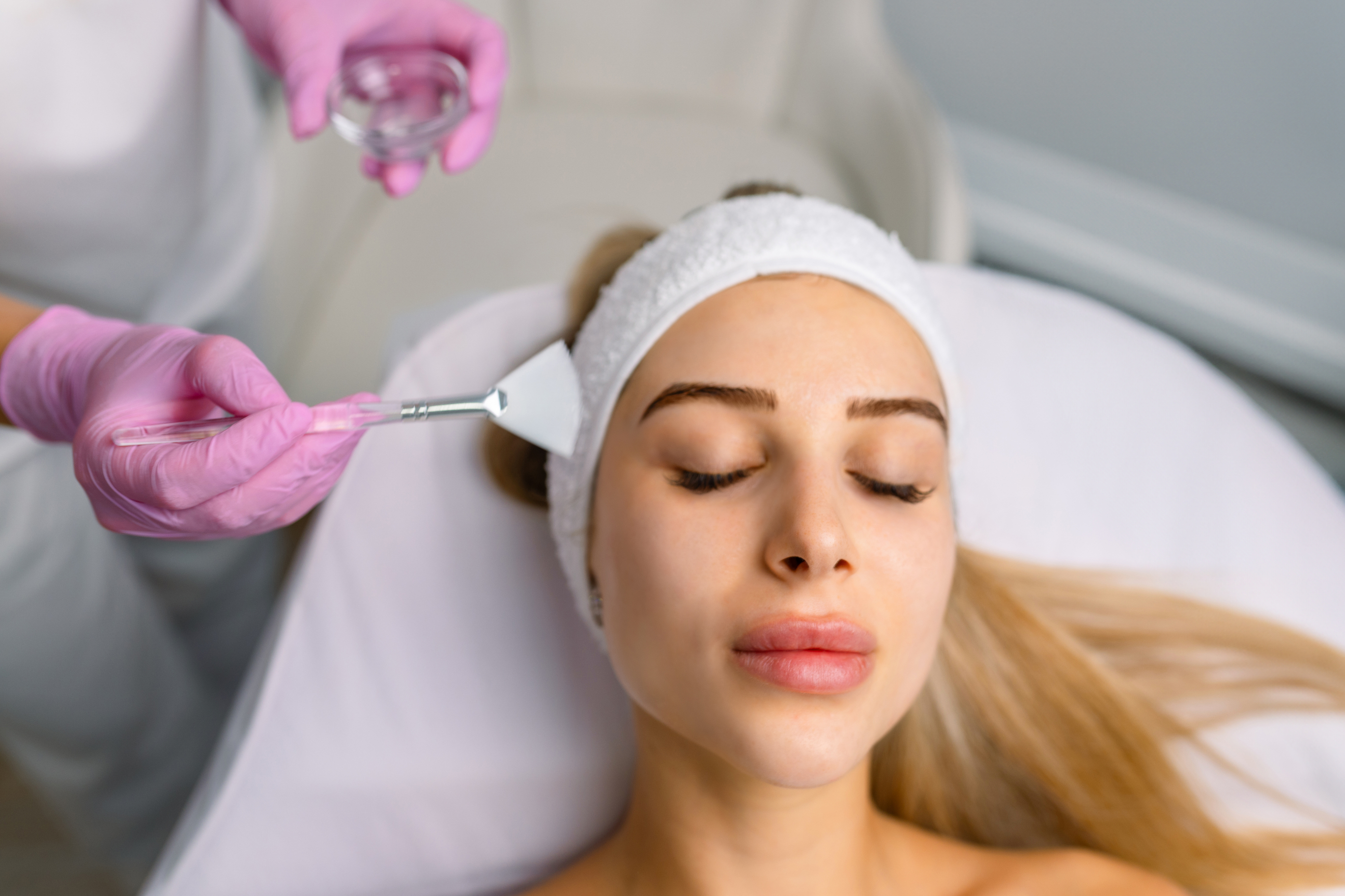 Chemical Peel