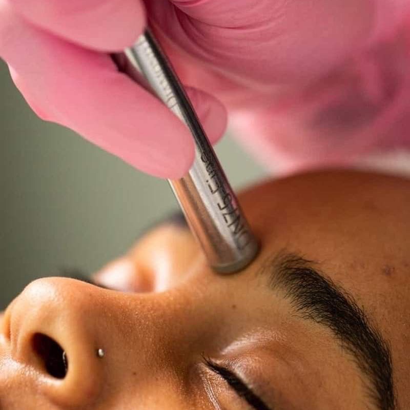 Microdermabrasion at Skin Blvd in houston, TX