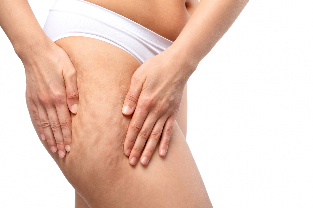 Premium Cellulite Vella Shape