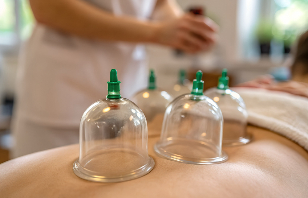 Cupping Add On