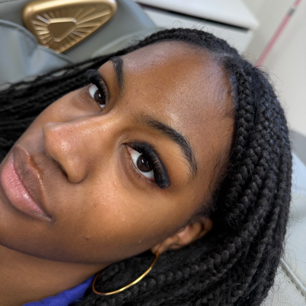 Volume Fill (4-5 Weeks) at Bombshell Aesthetics in Monaca, PA