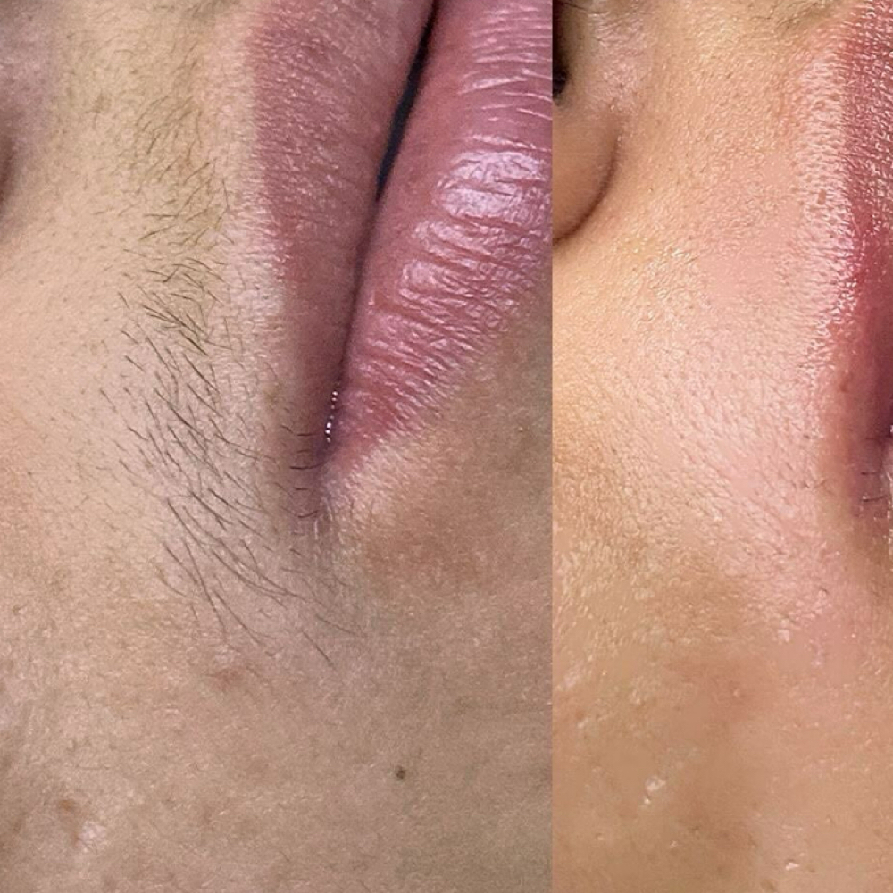Upper Lip at Charismatic Beauty in Apple Valley, CA