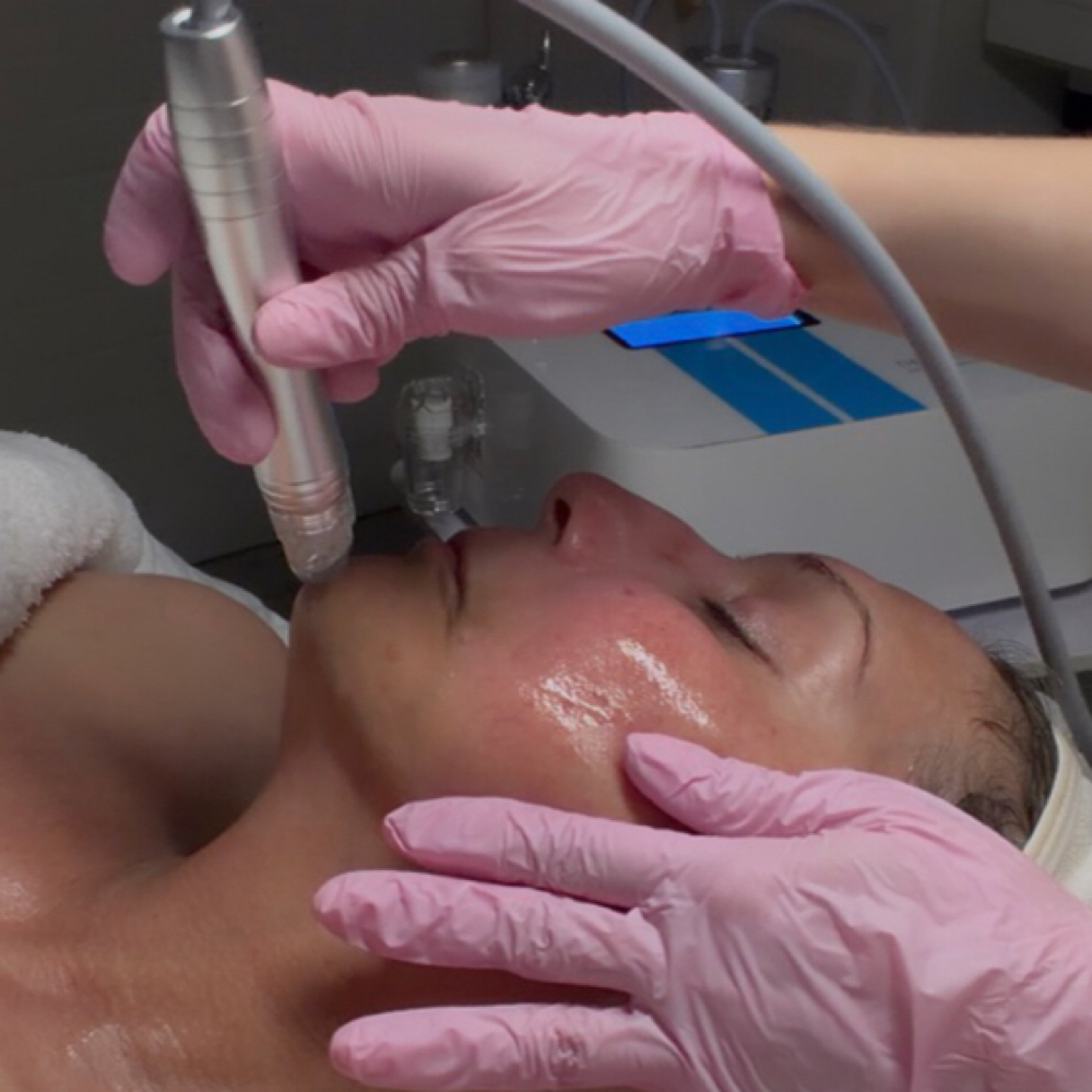 HydroDiamond Glow at Skin and Glow By Priscilla in Fort Worth, TX
