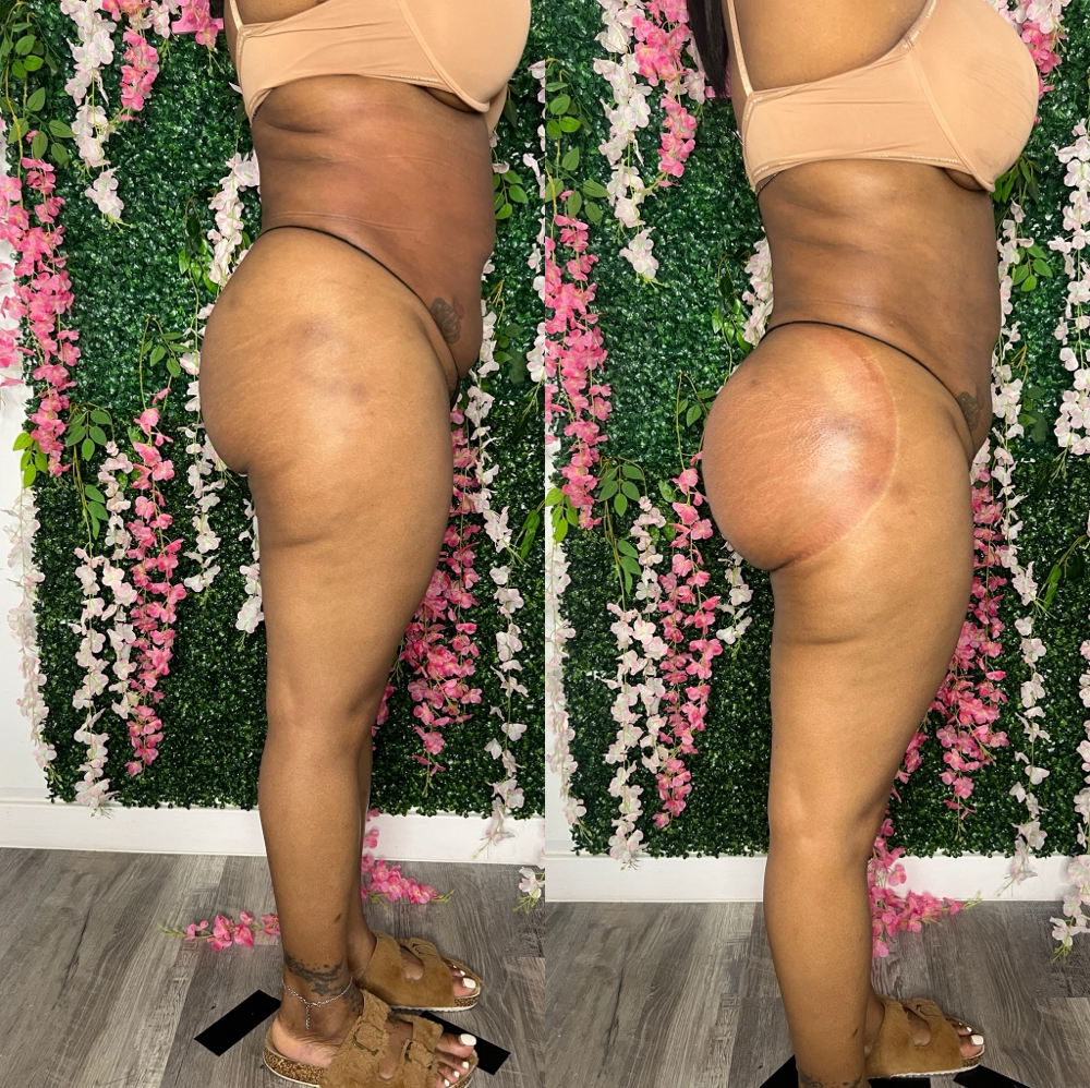 Tax Special Vacuum Bbl at HVS BODY in Shaker Hts, OH