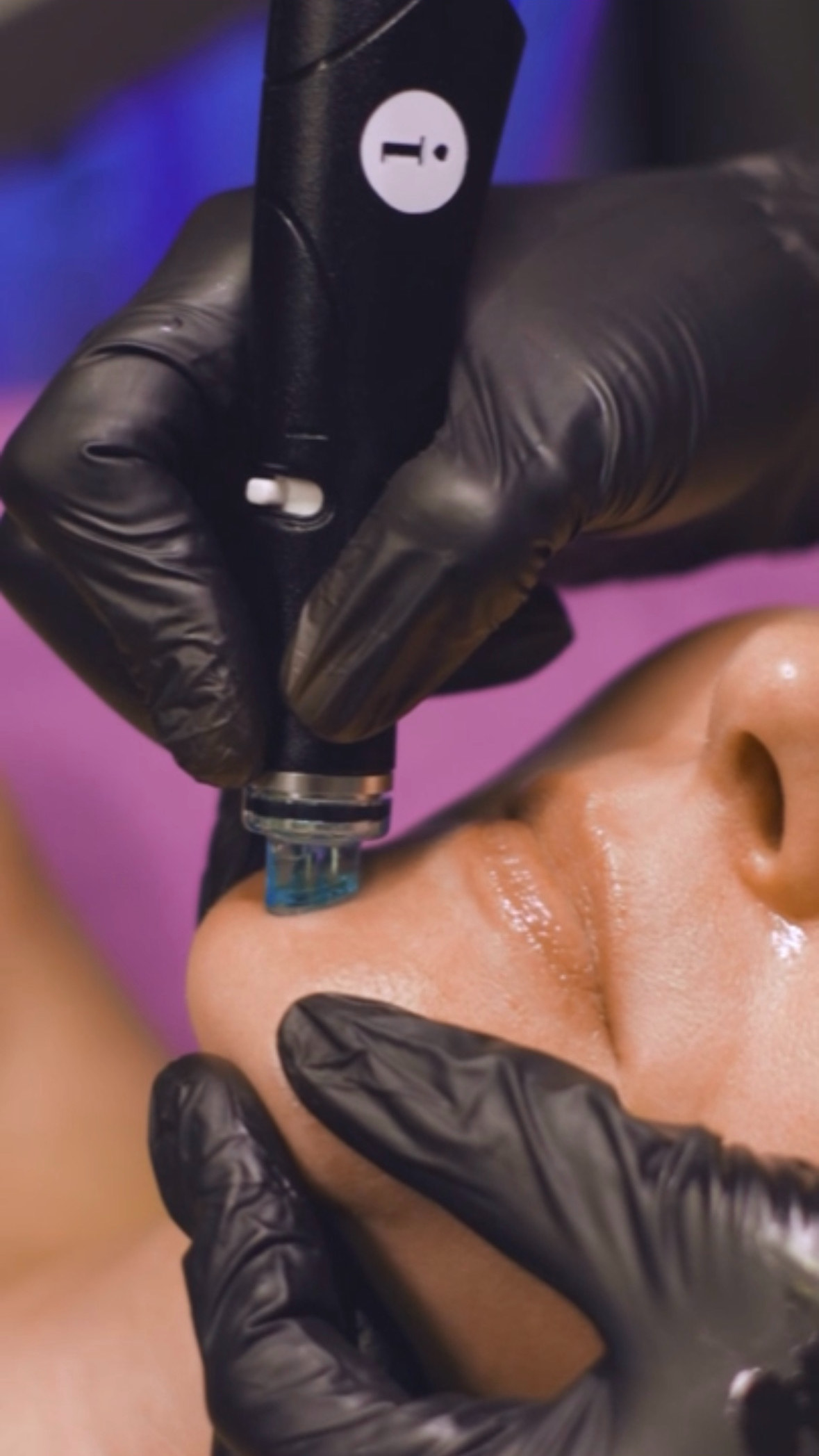 DELUXE HYDRAFACIAL* at Happyfaces.co in Valencia, CA