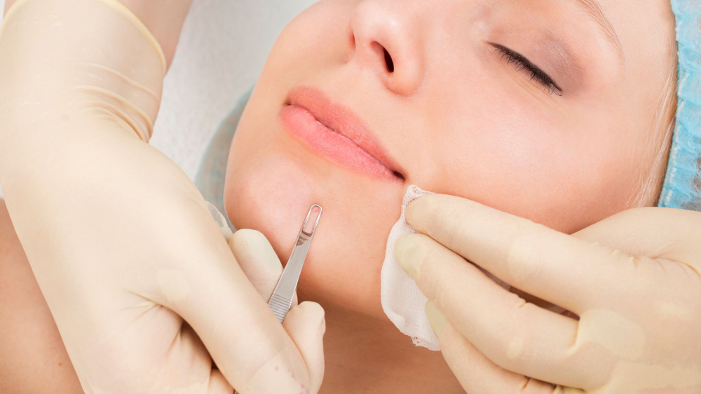 Facial Extractions Add-On