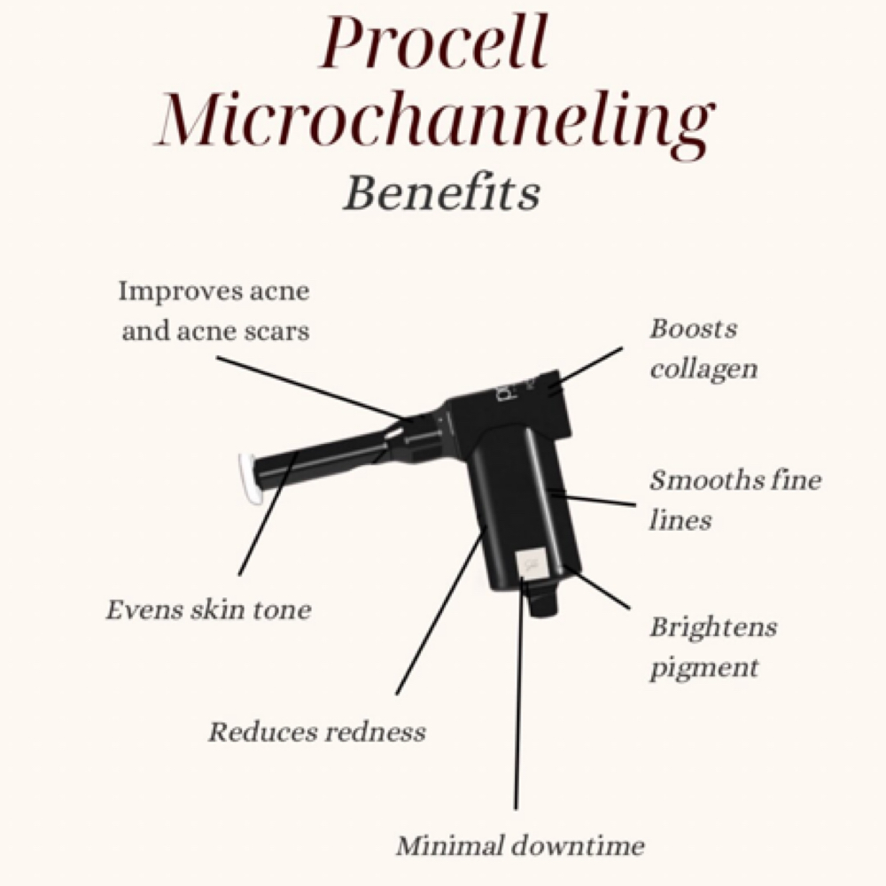 Procell Treatment Package Of 6 at After Glow Esthetics in Galt, CA