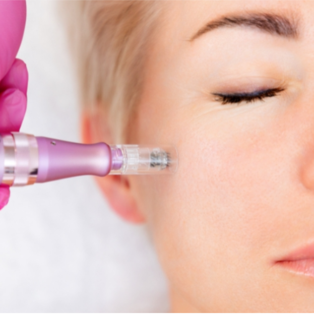 MICRONEEDLING AND DERMAPLANING at Buena Vida Health and Wellness in Lubbock, TX