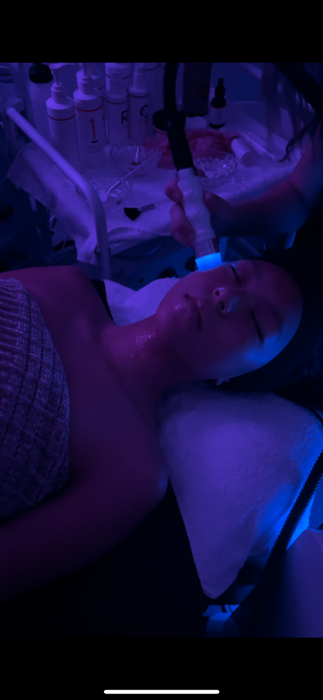 Radio Frequency Facial