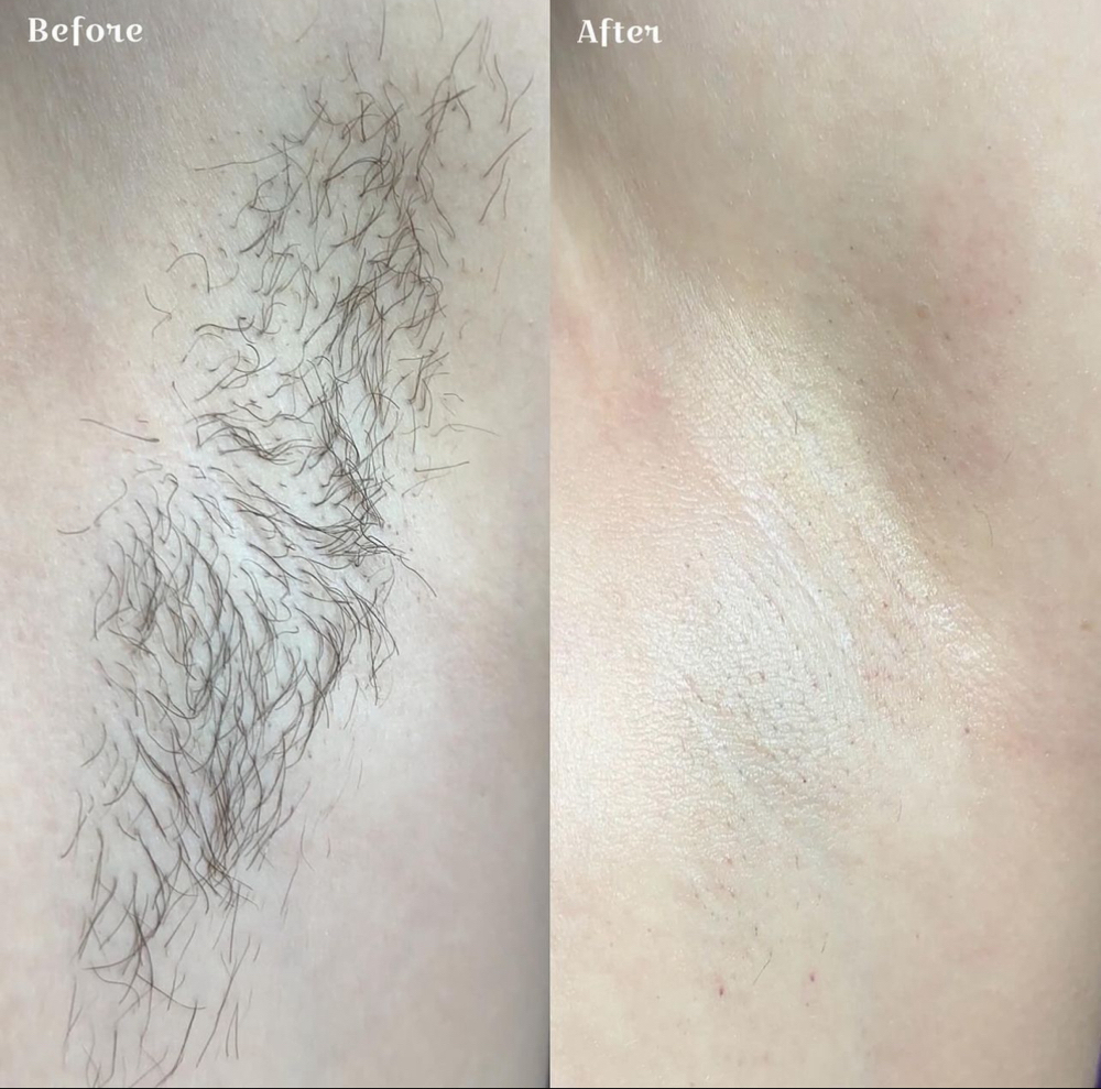 Under Arm Wax