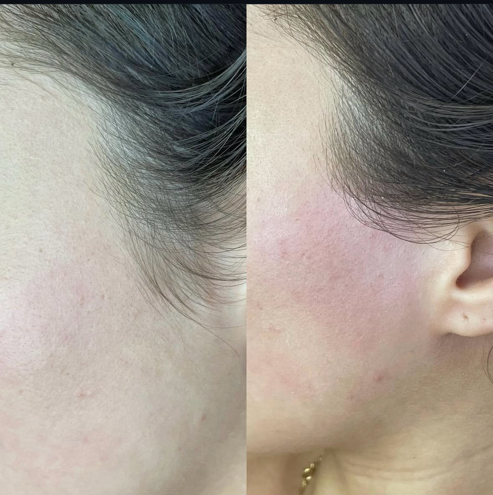 Side Burn Wax at Dreamy Eyes And Skin in Palm Springs, FL