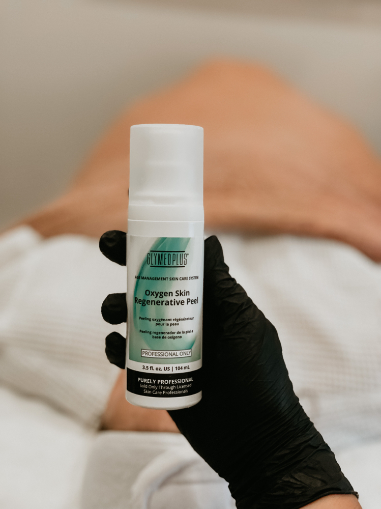 Oxygen Acne Treatment