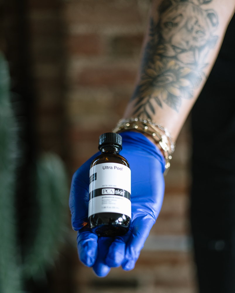 Chemical Peel Add-On