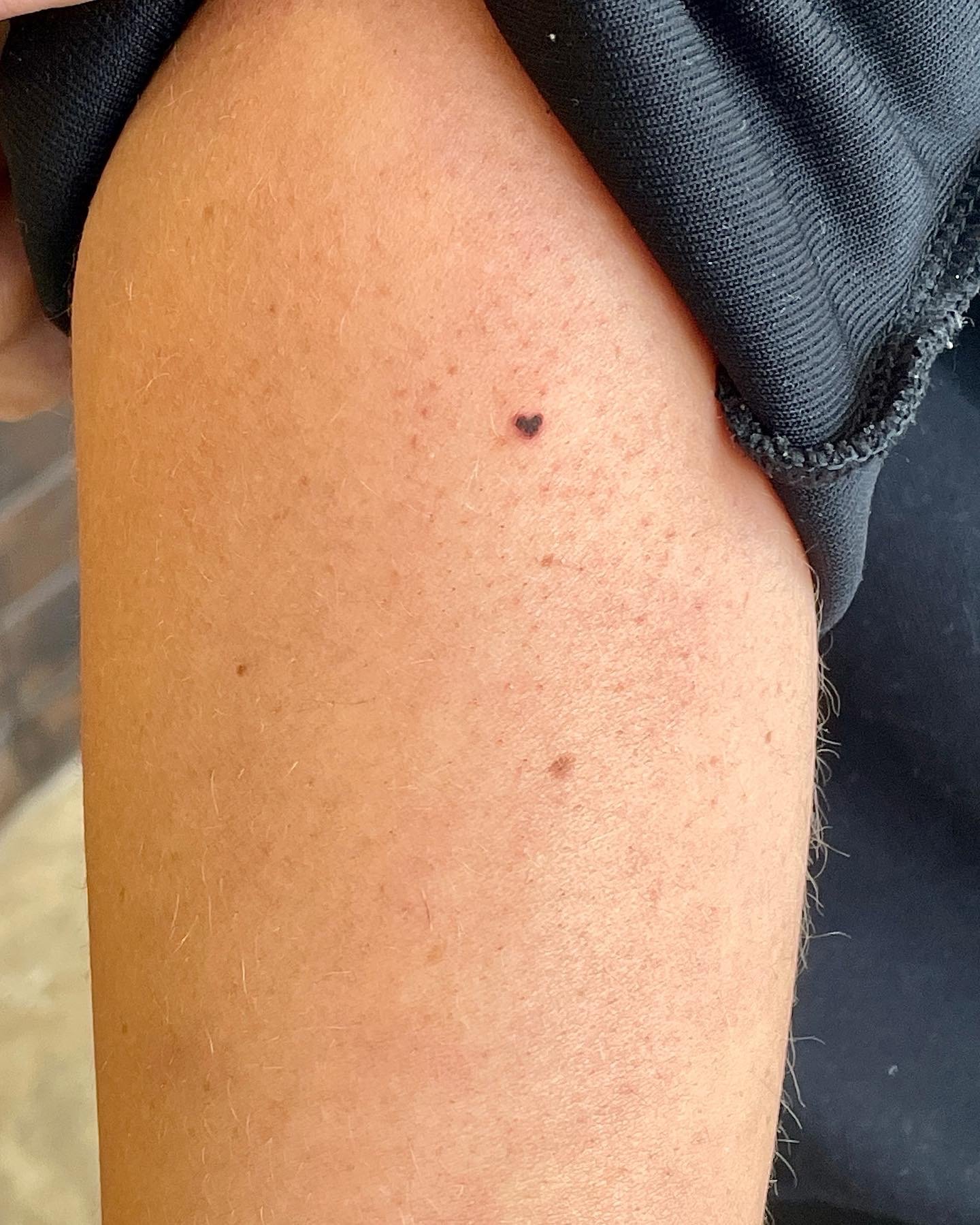 Heart Freckle Tattoo