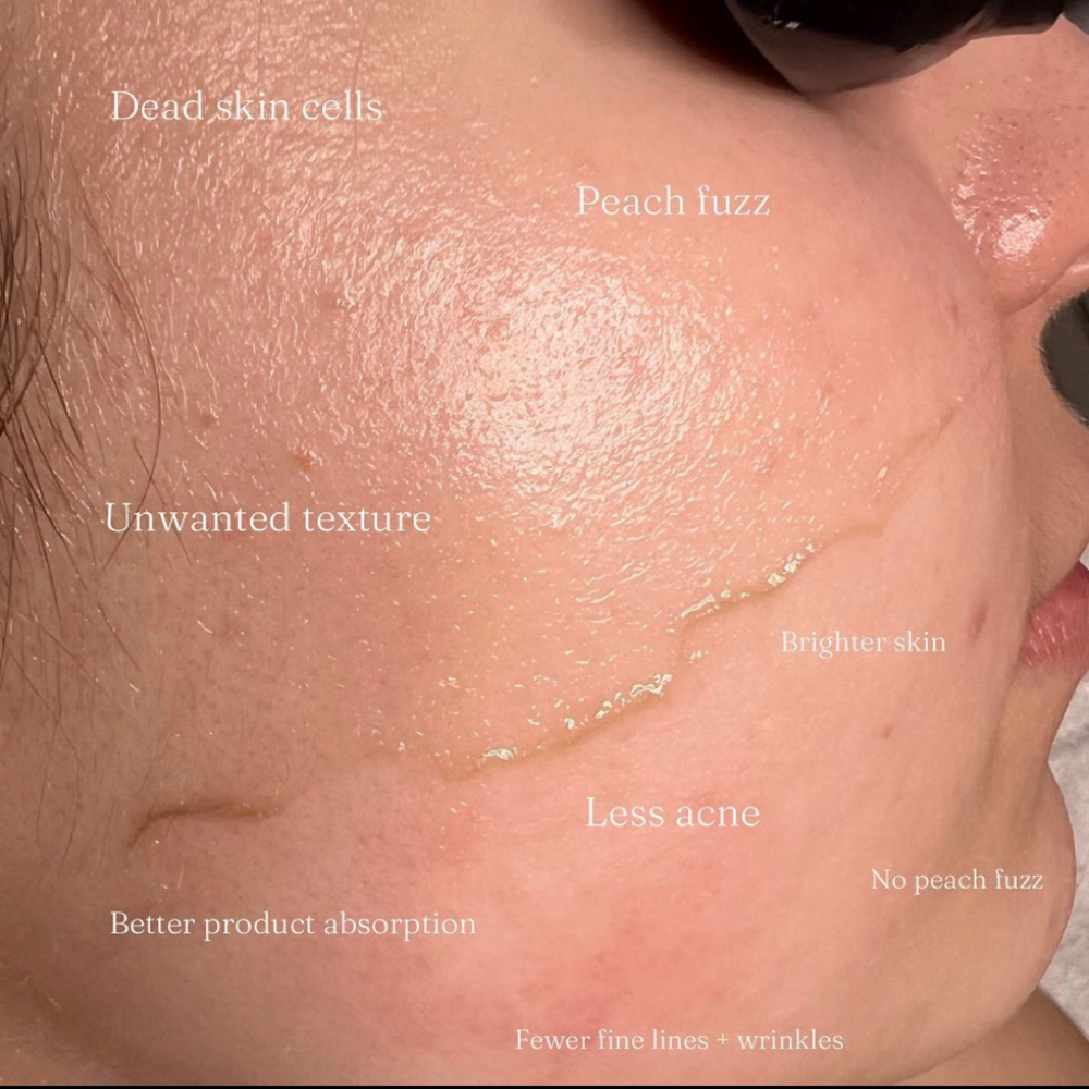 Dermaplaning Facial at Divine Lash & Brow Studio  - Nacogdoches, Texas in Nacogdoches, TX
