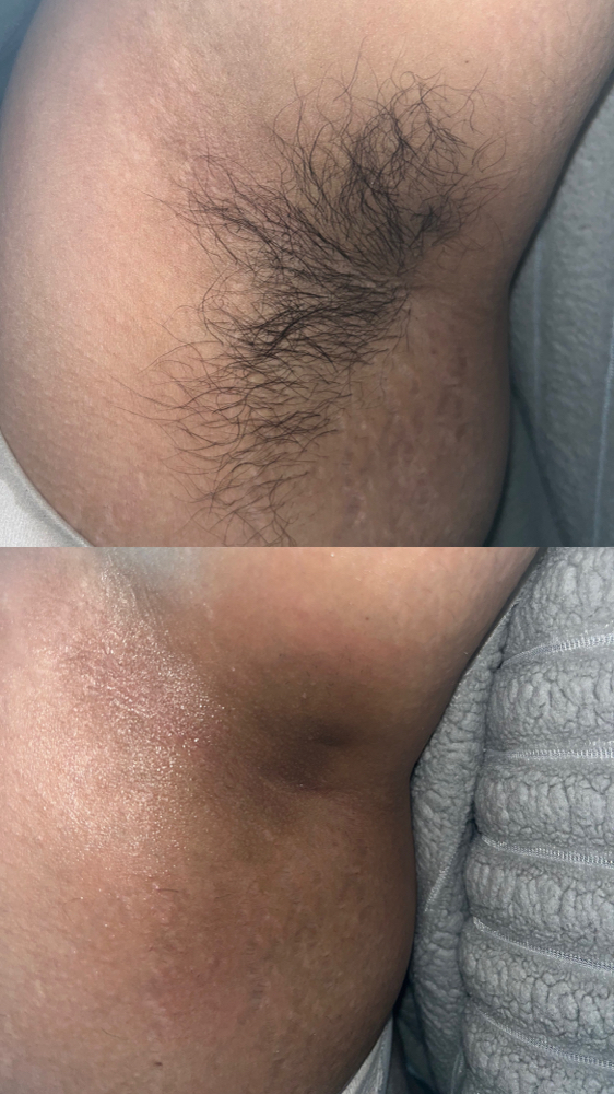 Underarm Wax at Ethereal Skin x Jenn in Bloomfield, NJ