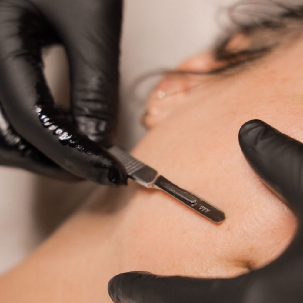 Dermaplane Renewal Facial