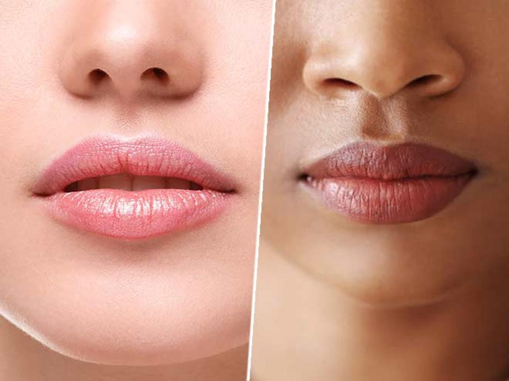 Lip Pigmentation Retouch Phase 1