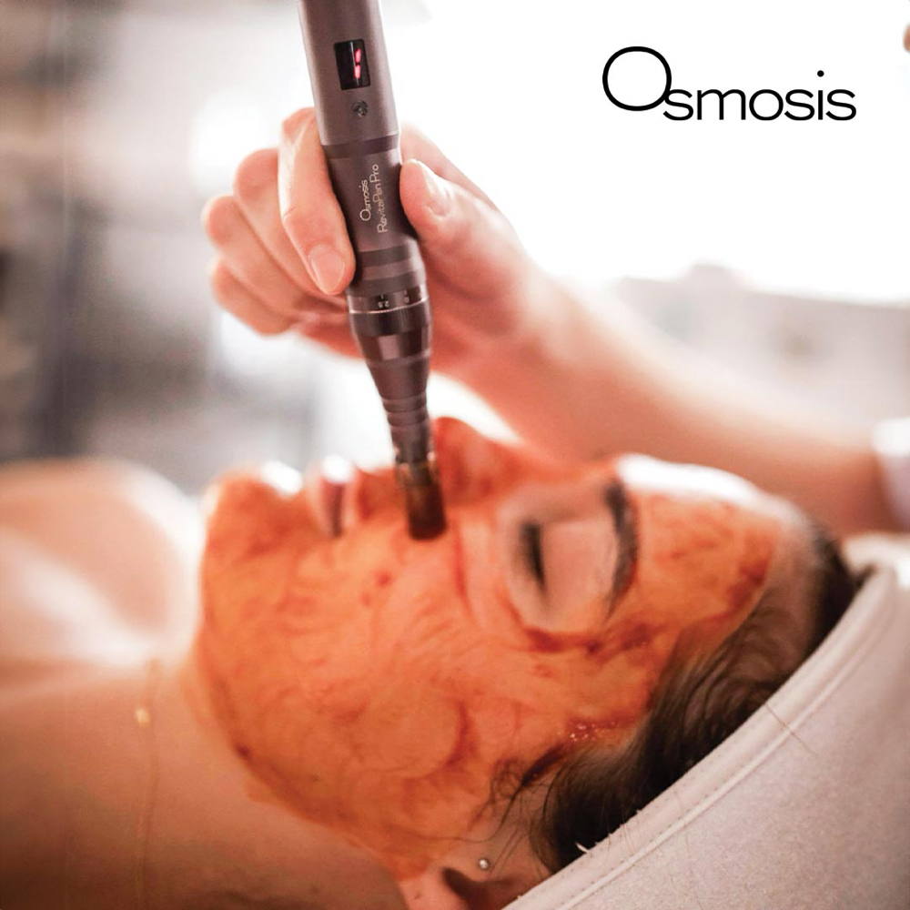 RevitaPen Facial Infusion at Holistic Hotdish at The Wellness Collective in Maple Grove, MN