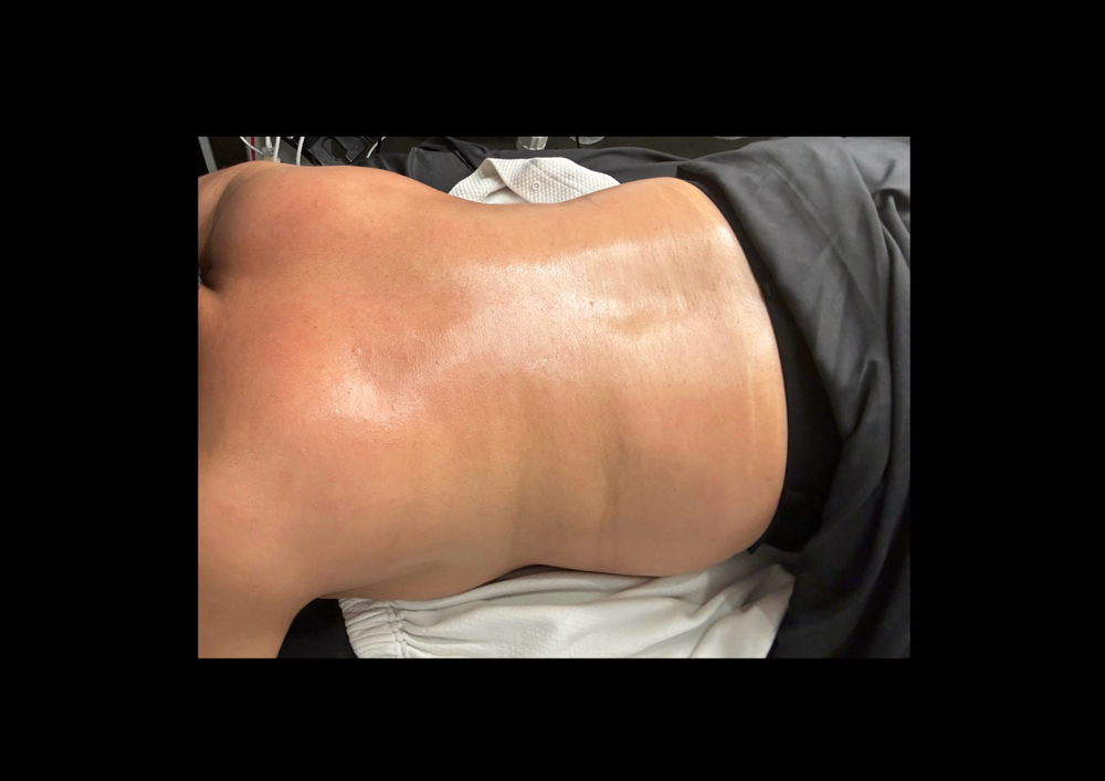 Back Facial